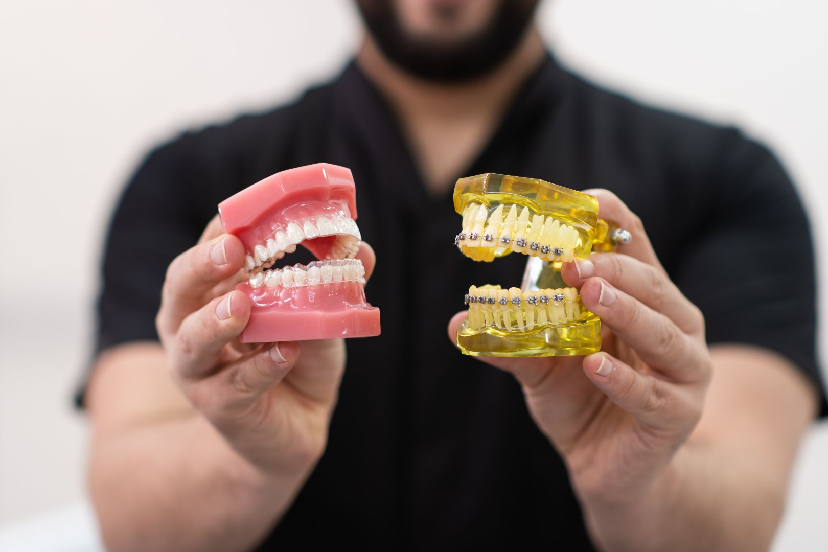 Clear Braces vs Metal Braces